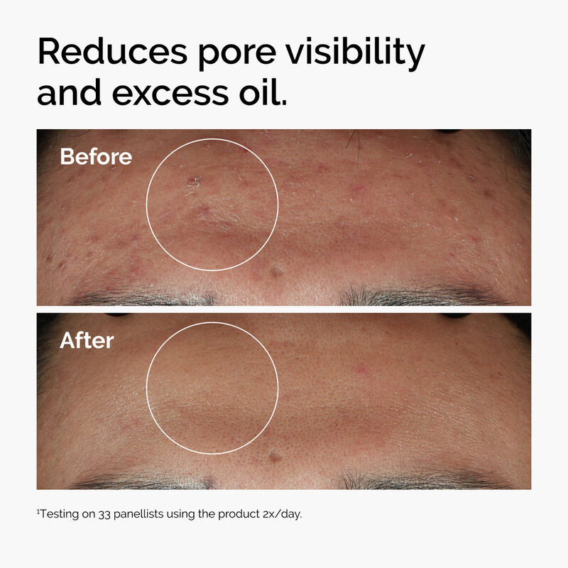 Eye Cream